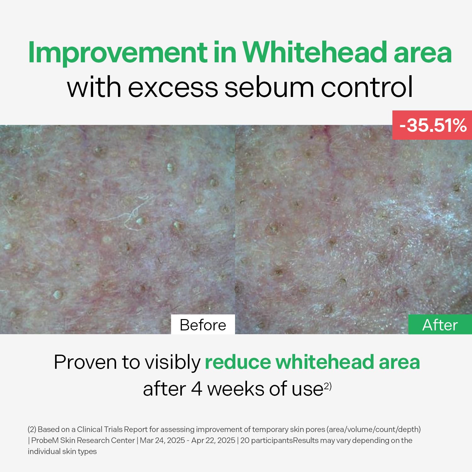 Torriden - Balanceful Control Serum (50ml)-thekimyoung.com
