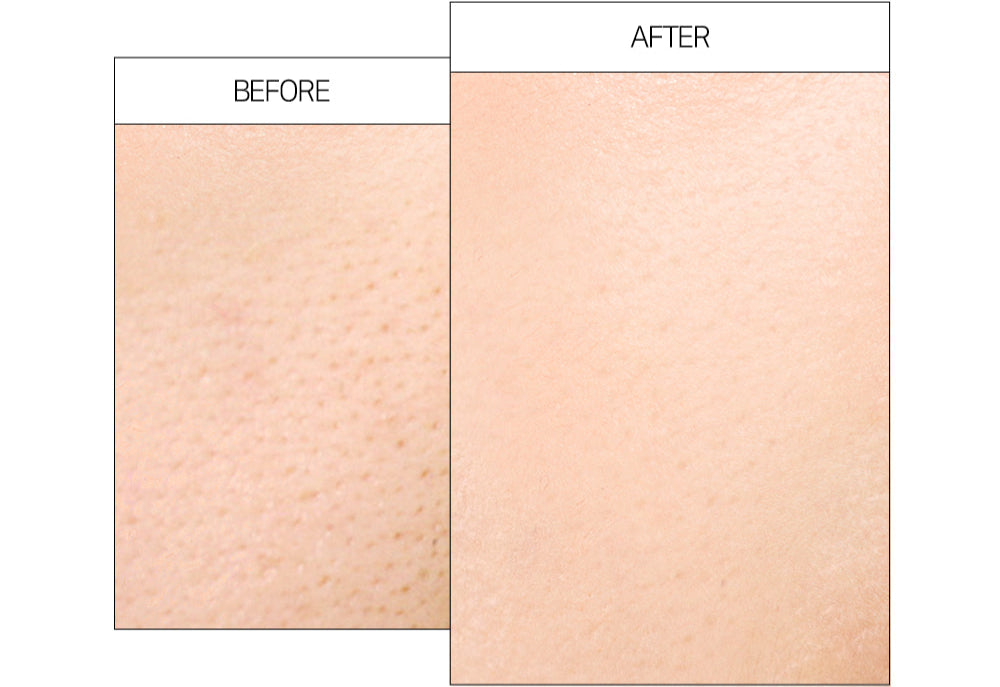 Sky EMS Ultrasonic Aqua Peeling Machine Galvanic Facial Massager AP1 Peeling SKY