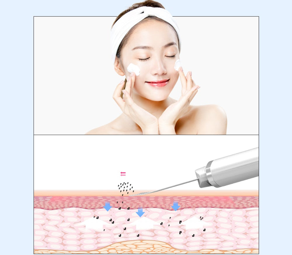 Sky EMS Ultrasonic Aqua Peeling Machine Galvanic Facial Massager AP1 Peeling SKY