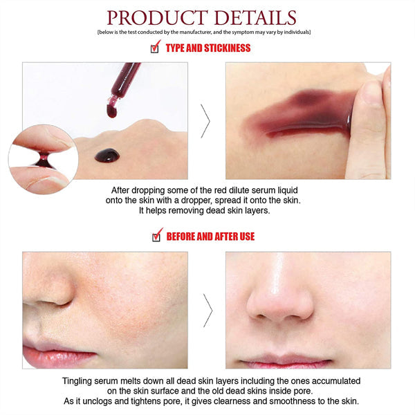 [so natural] Red Peel Tingle Serum 35ml Peel-Off Mask so natural