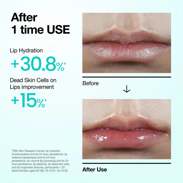 Anua - PDRN Lip Serum ( 10ml )-thekimyoung.com