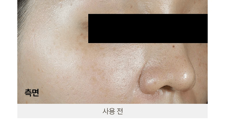 BIOHEAL BOH - Probioderm 3D Lifting Voluming Patch 4+1 Set (4.5gX5ea) [Oligio EDITION]-thekimyoung.com