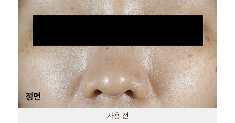 BIOHEAL BOH - Probioderm 3D Lifting Voluming Patch 4+1 Set (4.5gX5ea) [Oligio EDITION]-thekimyoung.com