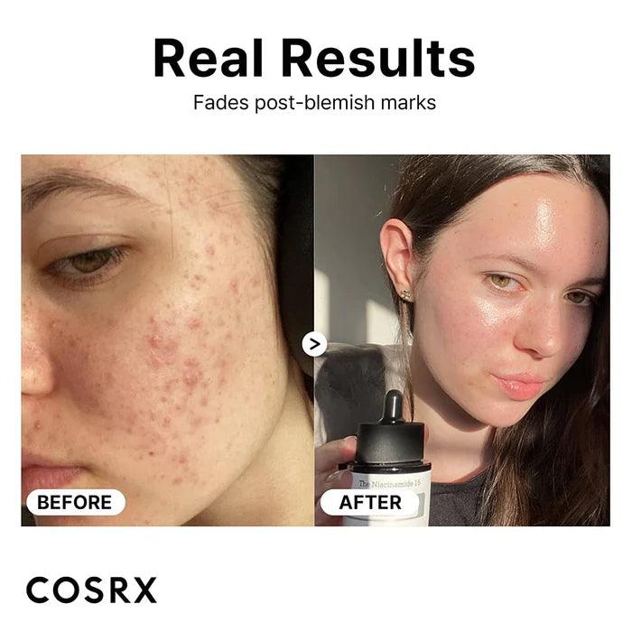 COSRX - The Niacinamide 15 Serum (20ml)-thekimyoung.com