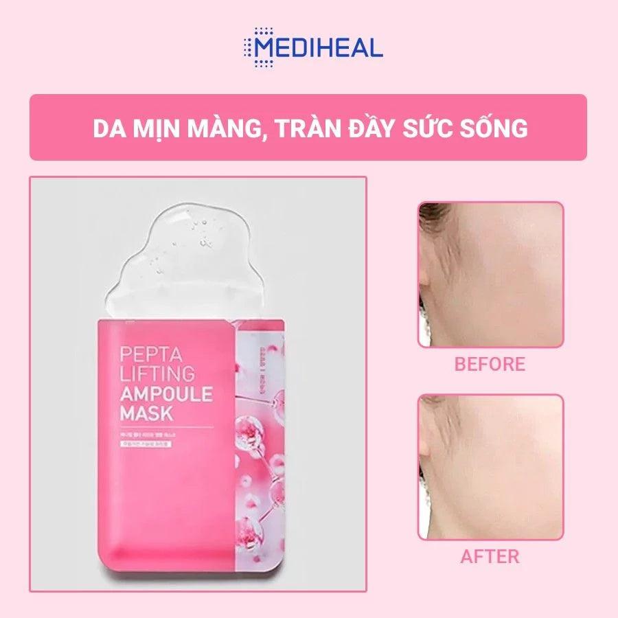 MEDIHEAL Pepta Lifting Ampoule MASK SHEET 20ml X 15pcs Mask Sheet MEDIHEAL