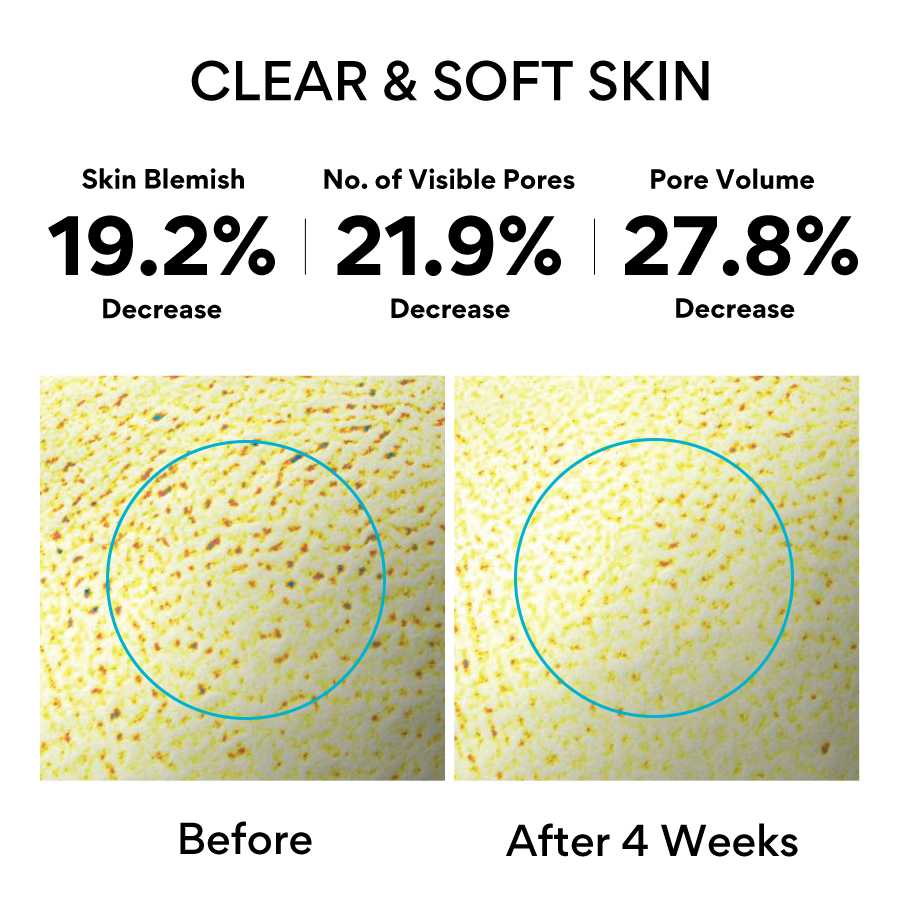 innisfree Retinol Cica Repair Ampoule - Soothing Pore & Blemish Care-thekimyoung.com