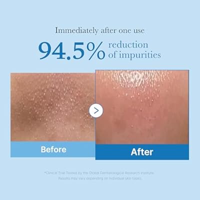 medicube Zero Pore Blackhead Deep Cleansing Oil 205ml CLEANSING OIL medicube