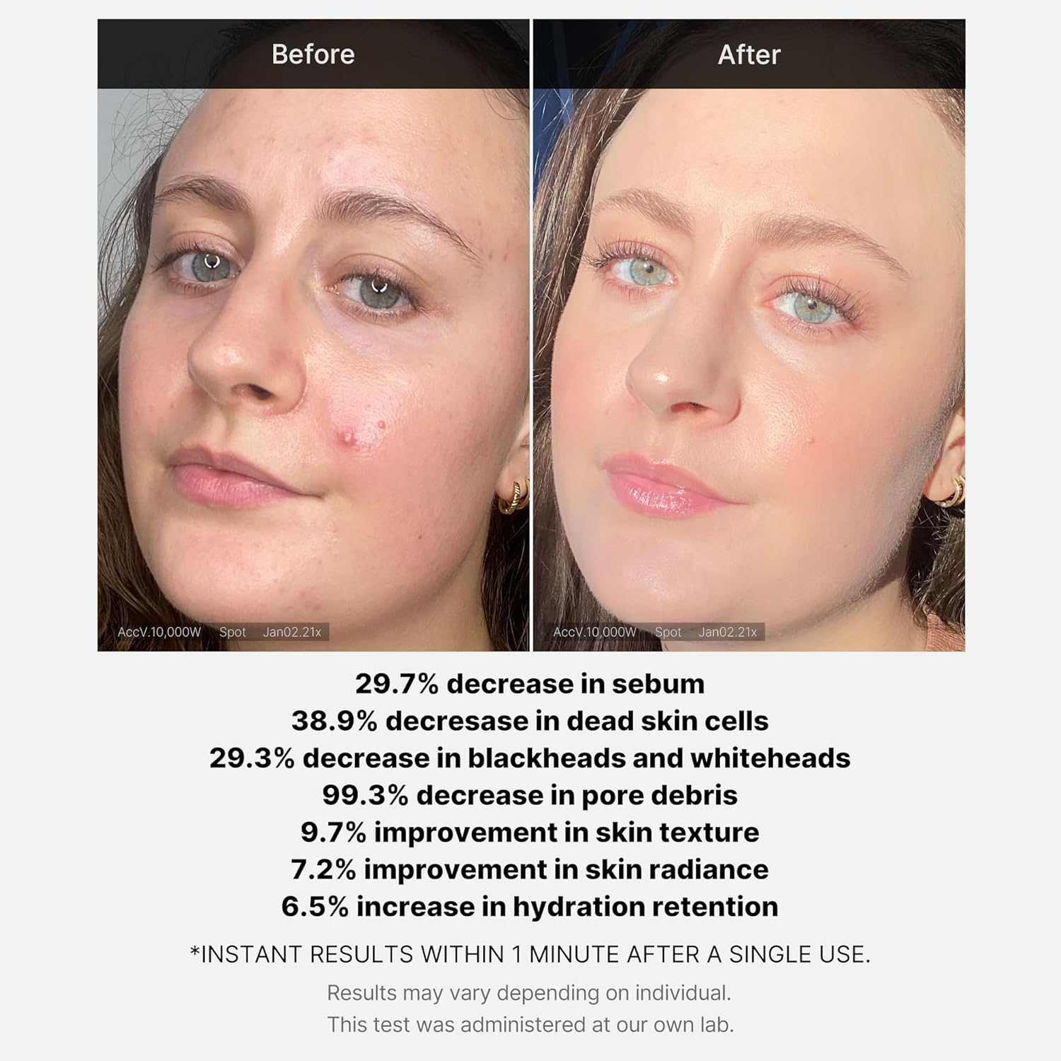 medicube Red Acne Succinic Acid Peel 40g-thekimyoung.com
