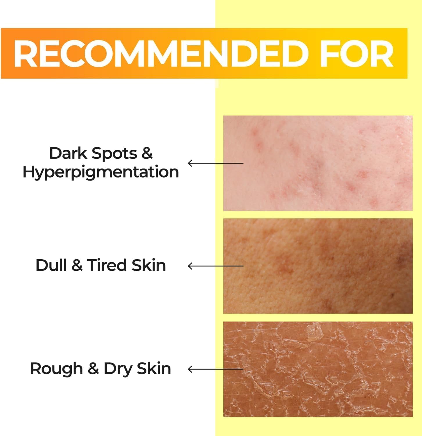 numbuzin No.5+ Vitamin Boosting Essential Toner-thekimyoung.com
