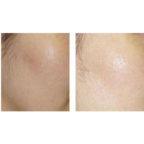 All NATURAL - Organic Mask Sheet Houttuynia Cordata 25ml x 5ea Mask Sheet all NATURAL