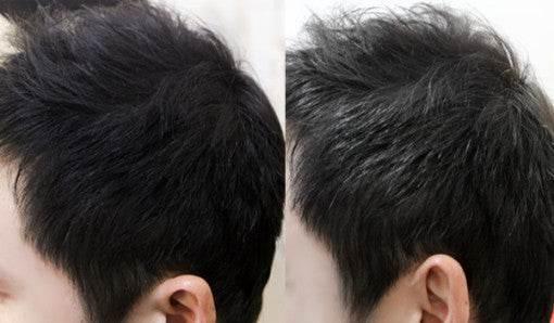 DASHU Daily Anti-Hair Loss Fixer Mist 120ml-thekimyoung.com