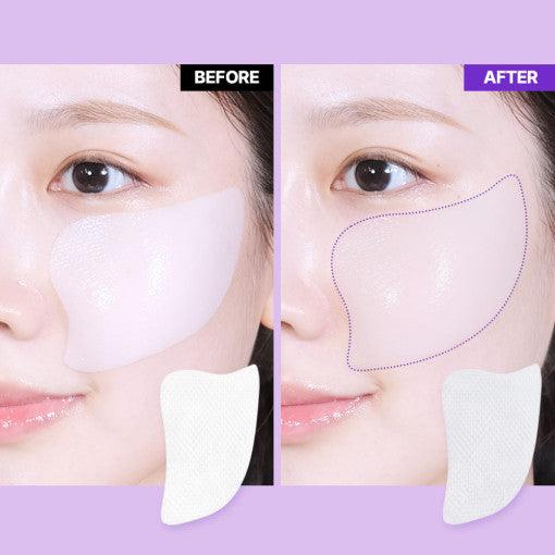 BIOHEAL BOH - Probioderm 3D Lifting Voluming Patch 4+1 Set (4.5gX5ea) [Oligio EDITION]-thekimyoung.com