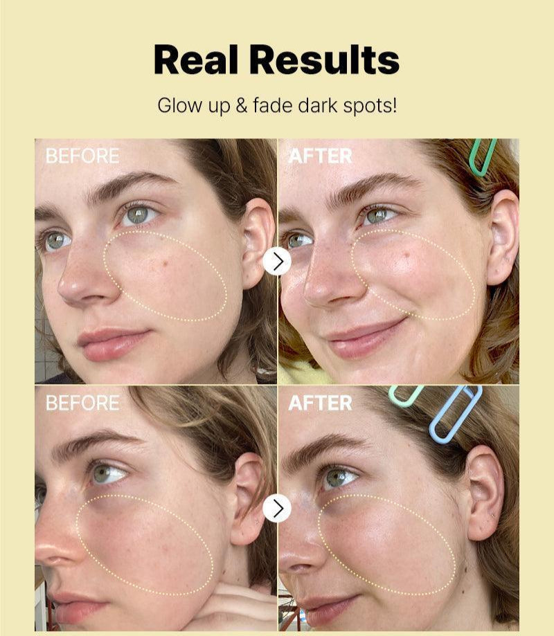 COSRX The Vitamin C 23 Serum 20ml Double Pack (20ml + 20ml) Face Serum COSRX