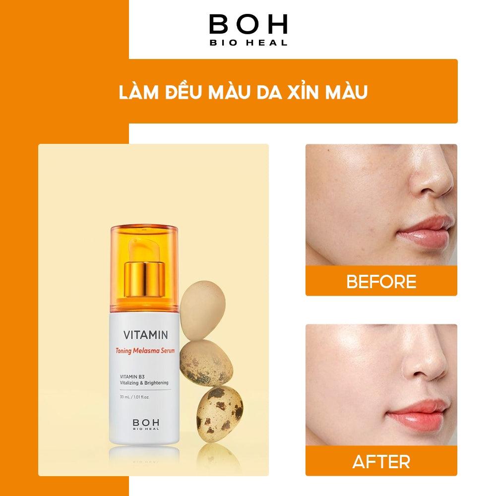 BIOHEAL BOH - Vitamin Toning Melasma Serum 30ml-thekimyoung.com